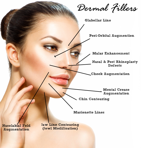 A woman with dermal fillers on her face.