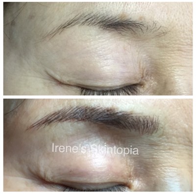 A before and after photo of the brows of a woman.