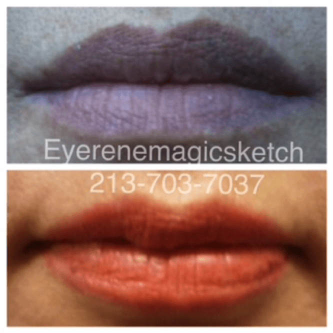 A before and after picture of the lips.
