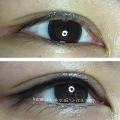 A before and after photo of the eyes of two women.