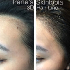 A woman 's hair is shown before and after using the 3 d hair line.