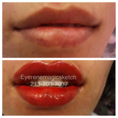 A before and after picture of the lips of a woman.