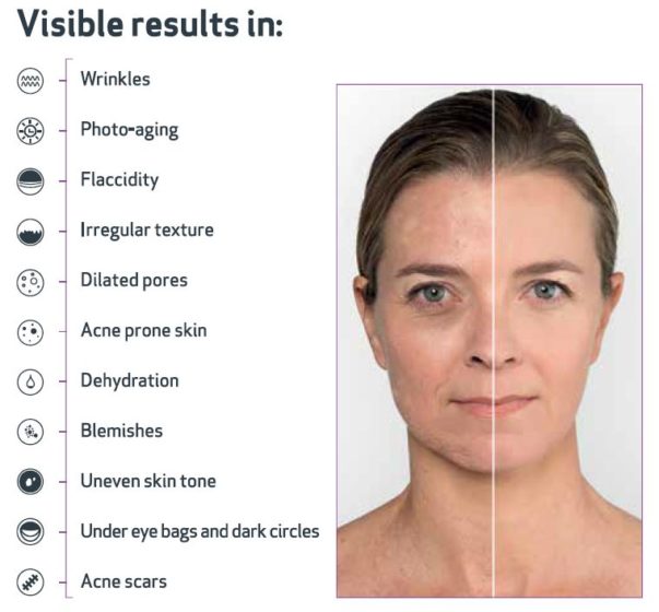 A woman 's face with various skin conditions and their visible results.